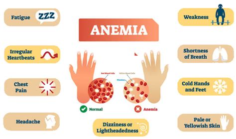 Anemia Types Causes Symptoms Treatments Solution Phar