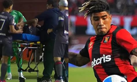 Paolo Reyna Escalofriante lesión del jugador de Melgar impacta a nivel internacional América