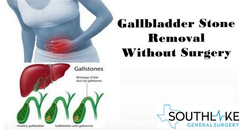 Gallbladder Burning Sensation How Do I Know If Pain Is Caused By My