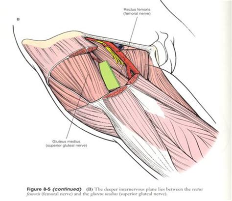 Hip Anterior Approach Smith Petersen Approaches Orthobullets