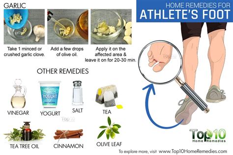 Home Remedies For Athletes Foot Top 10 Home Remedies