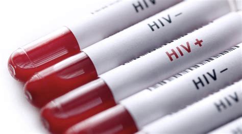 Prep Hiv Prevention Pill In Malaysia Premier Clinic