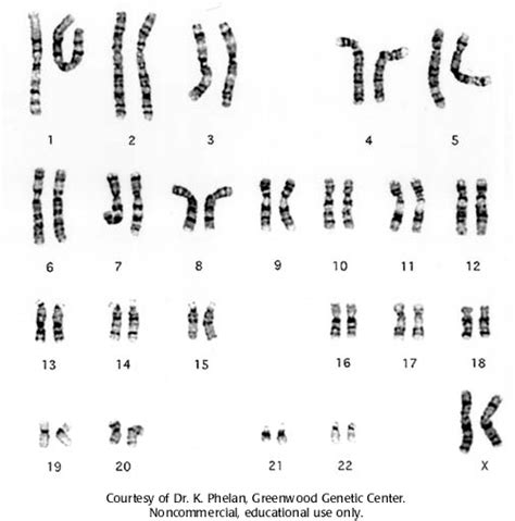 Student exploration human karyotyping gizmo answer key. Karyotype