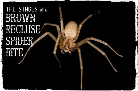 Brown Recluse Bite Pictures Stages Symptoms Treatment Hubpages