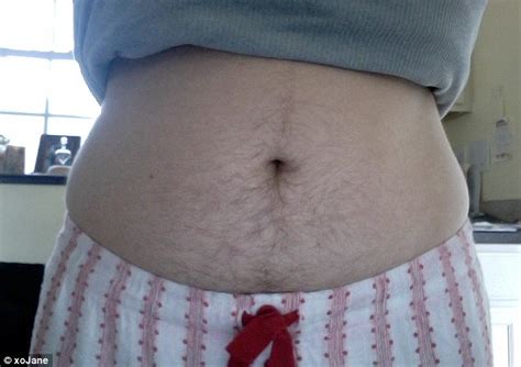 Aggregate More Than Hair On Belly Woman Best Poppy