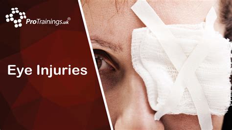 Eye Injuries Sports First Aid Level 3 Vtq Online Training Video