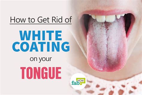 How To Get Rid Of A White Coated Tongue With Just 1 Ingredient White