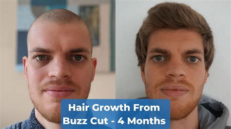 Hair Growth Time Lapse 4 Months From Buzz Cut Youtube