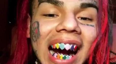 6ix9ine Celebrates Gummo Getting 100 Million Views By Getting New Teeth Video