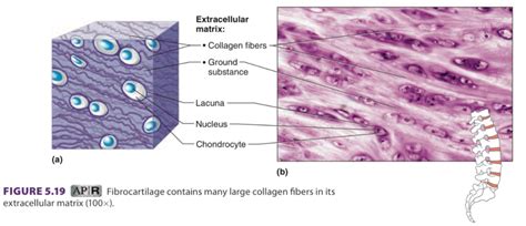 Fibrocartilage Connective Tissue Labeled