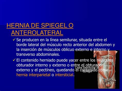 Ppt Patología Herniaria De La Pared Abdominal Del Concepto A La