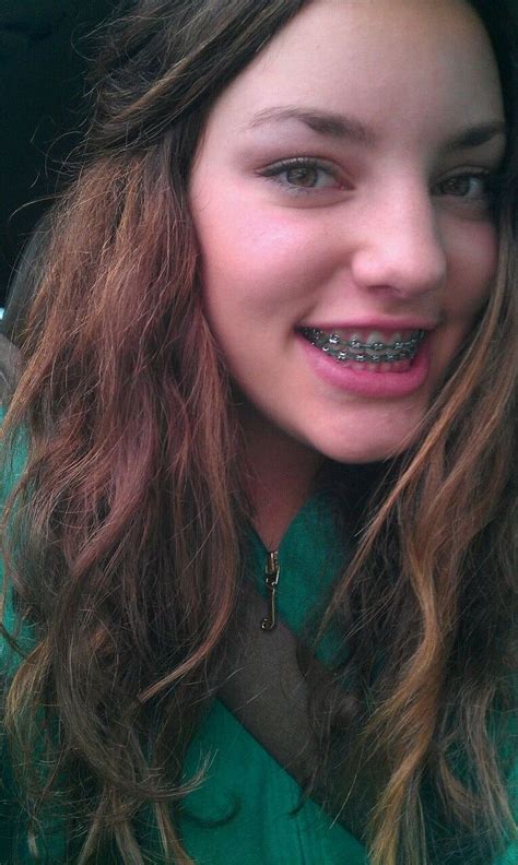 Girls With Braces Green Looks Good On Her Pretty Face Girl Beauty