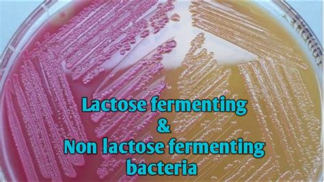 Bacterias Fermentadoras De Lactose Ensino