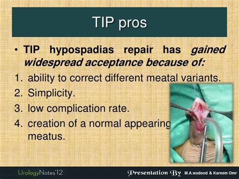 Hypospadias 2 New Techniques Longitudinal Preputial Flap And Single St