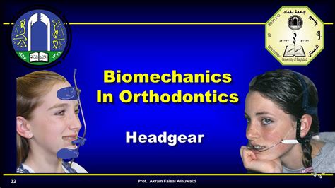 Use Of Headgear In Orthodontics Youtube