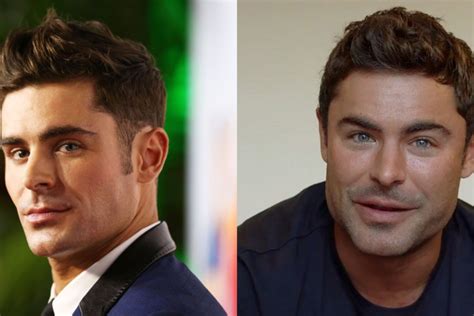 jaw gate zac efron denies he s done plastic surgery the citizen