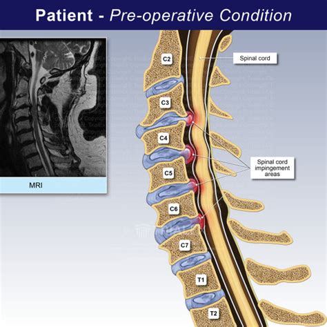 pre operative condition trialexhibits inc