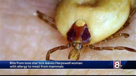 Aggressive Tick Which Can Cause Meat Allergy Expanding Into New England