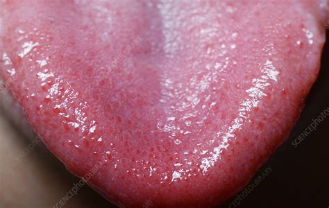 Tongue Anatomy Taste Buds