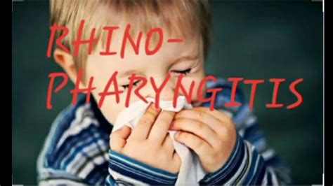 Acute Rhinopharyngitis Common Cold In Children Youtube