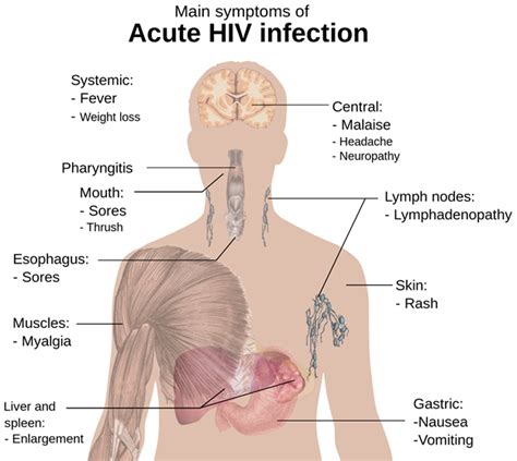 Aids And Hiv Discover The Causes Symptoms And Treatments