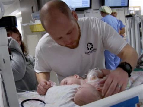 Conjoined Twins Allison And Amelia Photo 12 Pictures Cbs News