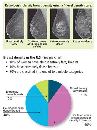 Breast Density And Dense Breast Tissue Scottsdale Medical Imaging Smil
