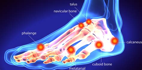 What Is Foot Bursitis And How Is It Treated Foot Hq Podiatry Foot