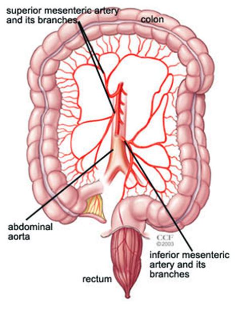 Pulmonaey artery carries blood from the right side of the heart to the lungs. Intestinal Ischemic Syndrome