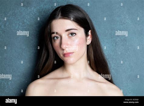 Female With Skin Rash On Face Stock Photo Alamy