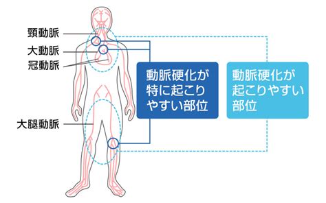 The site owner hides the web page description. 動脈硬化の改善、心筋梗塞・脳梗塞の予防について|北青山D ...