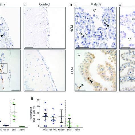 Distribution Of Cd8 T Cells In The Leptomeninges And Choroid Plexus