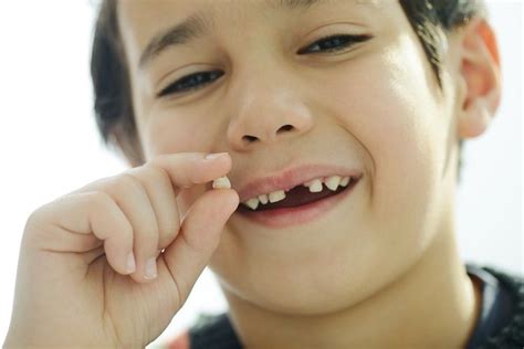 Just because there's some movement doesn't mean the tooth is going to fall out. Tips to Pull Out a Loose Tooth Painlessly | Loose tooth ...
