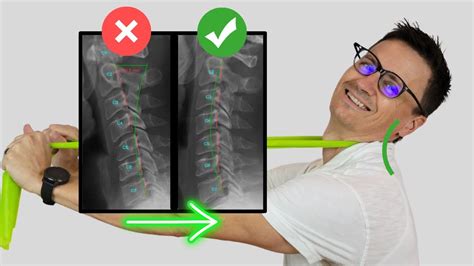 Best Exercise To Fix Loss Of Neck Curve Cervical Lordosis Or Military