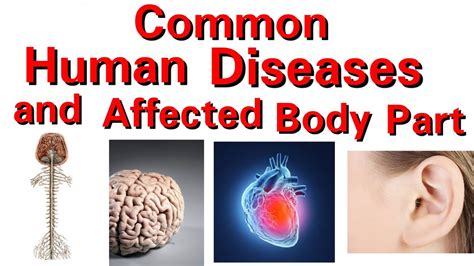 Common Human Diseases And Affected Body Part Youtube