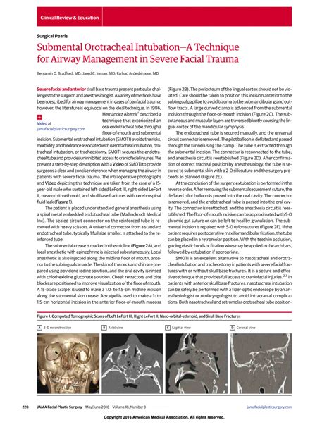 Submental Orotracheal Intubation—a Technique For Airway Management In