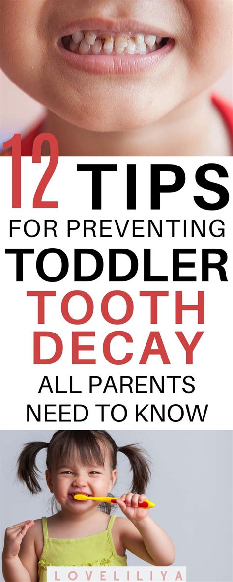 Tips On Toddler Cavity Prevention And Brushing That Every Parent Should