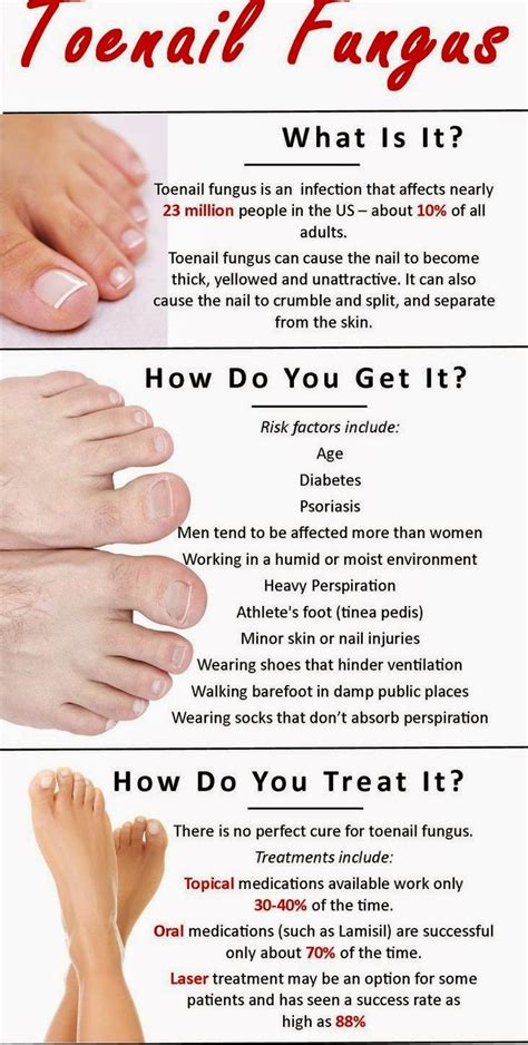 How To Get Rid Of Toenail Fungus What Remedies Work