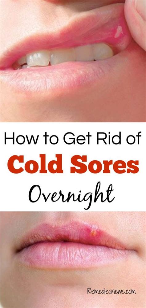 Red Dot On Lip Not Cold Sore