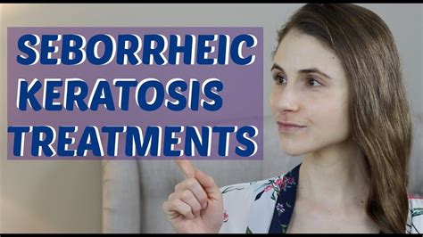 Seborrheic Keratosis Treatments Including Eskata Dr Dray Youtube