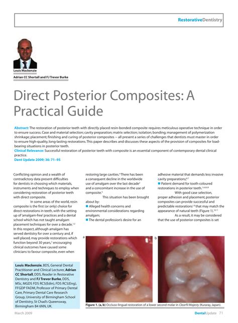 Pdf Direct Anterior Composites A Practical Guide