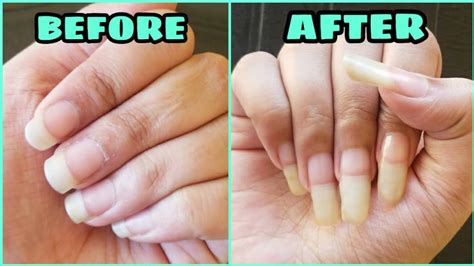 How To Grow Nails Faster At Home With One Ingredient😲requested Video