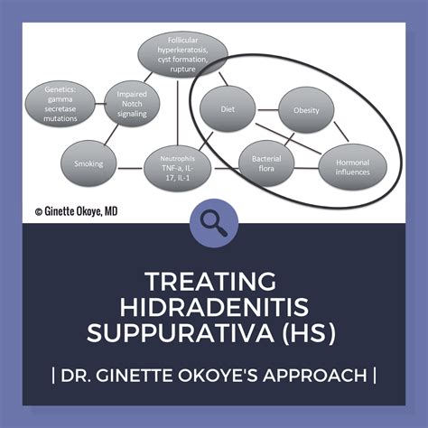 Treating Hidradenitis Suppurativa Hs Dr Okoyes Approach Next