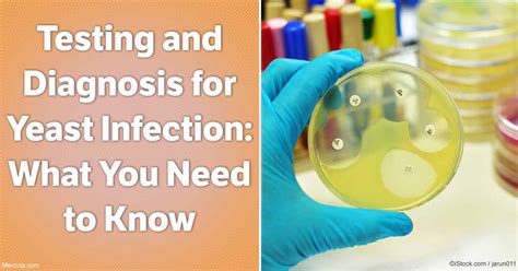 Testing And Diagnosis For Yeast Infection What You Need To Know