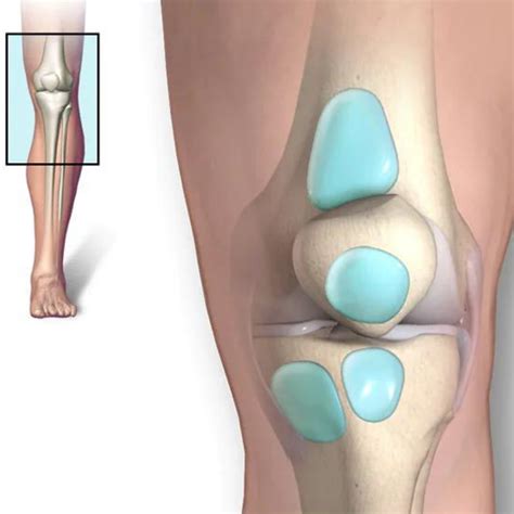 Bursitis Knee Pain Carolinas Pain Center Pain Relief Options