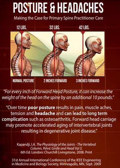 Chiropractic And Posture