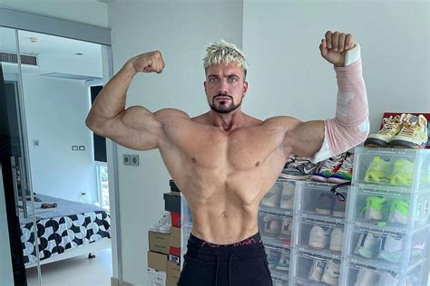 German Bodybuilder Shows How Quickly You Can Lose Muscle Through Inactivity