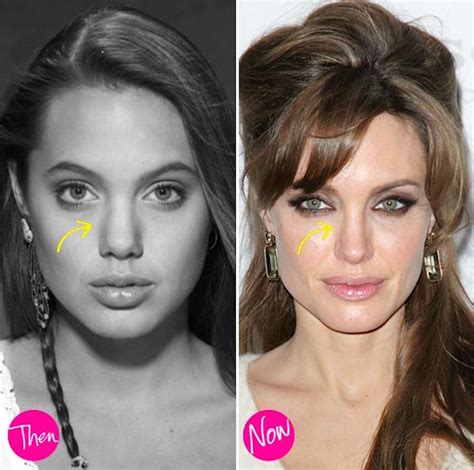 These 15 Celebrities Don’t Want To Tell You They Did A Plastic Surgery It’s So Obvious