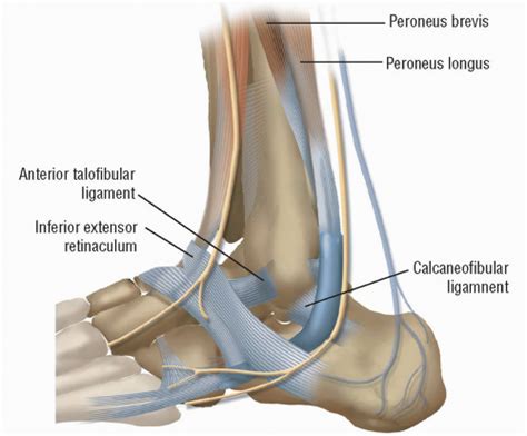 Anatomic Repair Of Lateral Ankle Instability Musculoskeletal Key