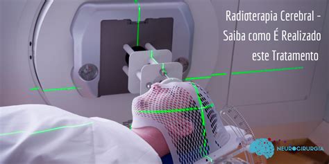 Radioterapia Cerebral Saiba Como Realizado Este Tratamento